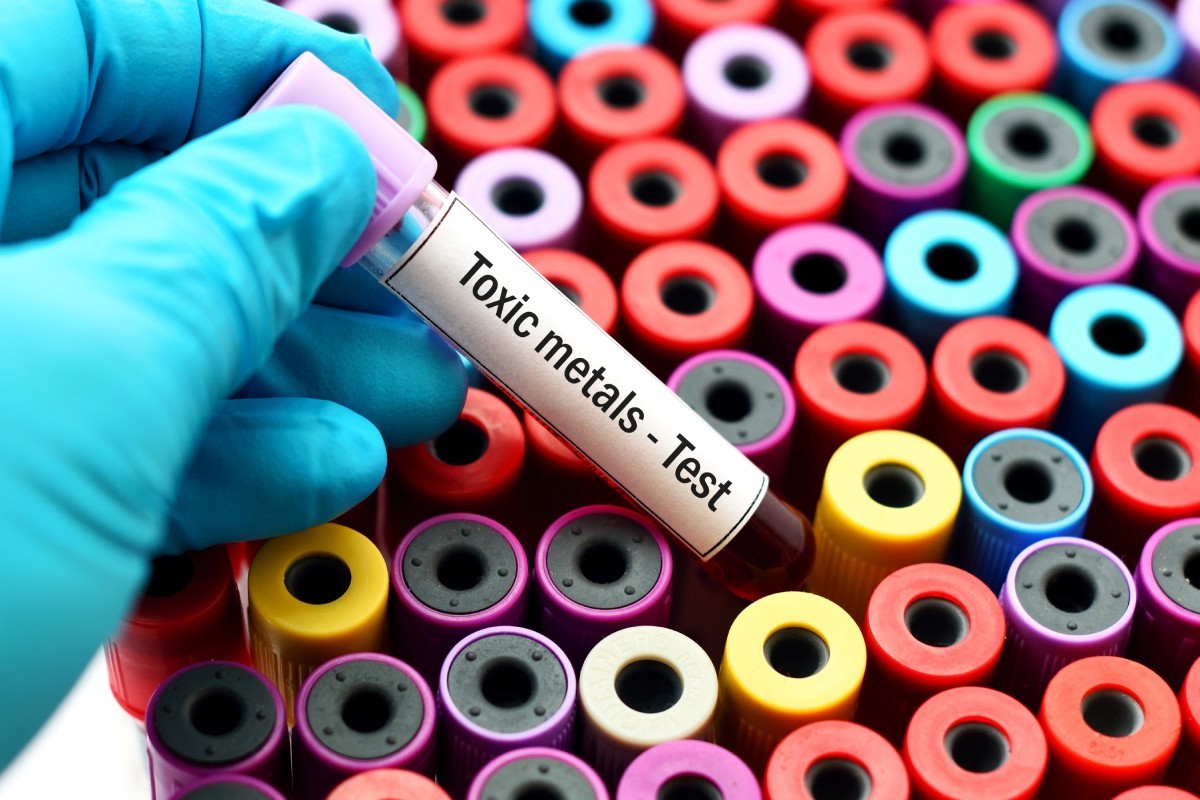 Toxic metals test